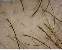 Haardichte am Anfang&hellip;